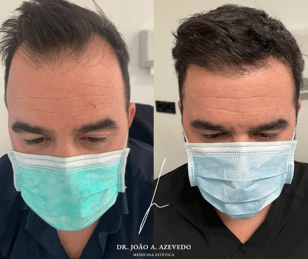 “Processo indolor, com rápida recuperação e equipa experiente. Recomendo!” -  (Ricardo Malheiro)