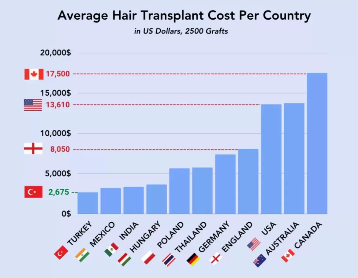 Transplantes Capilares em números crescentes
